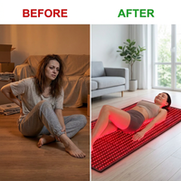 Red and Near-Infrared Light Therapy Mat for Whole Body — Before & After
